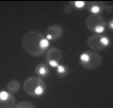 Fluorescence image of proteasomes in yeast cells