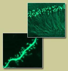 confocal1